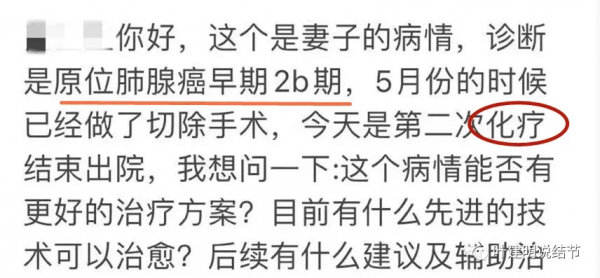 醫生也會錯：有關肺結節幾個需要澄清的關鍵問題