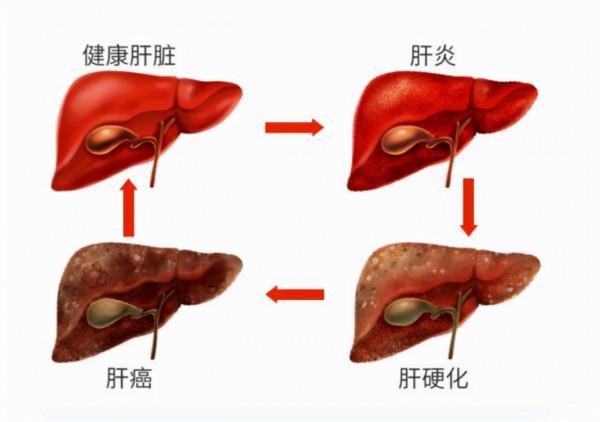 “喝白酒”跟“喝啤酒”,哪個對身體的傷害大?愛喝酒的瞭解一下 “喝白酒”跟“喝啤酒”,哪個對身體的傷害大?愛喝酒的瞭解一下