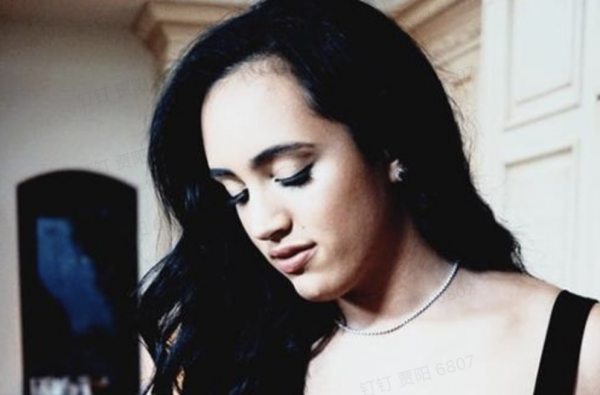 有種基因叫“強森女兒”，本以為是“金剛”，沒想到卻是芭比娃娃