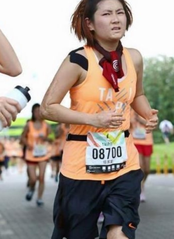 燒傷後被“暖男”拋棄，張承中直言看到Selina燒傷腿部：真的想吐