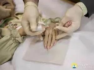 高度腐敗的屍體,又如何推測死亡時間 高度腐敗的屍體,又如何推測死亡時間