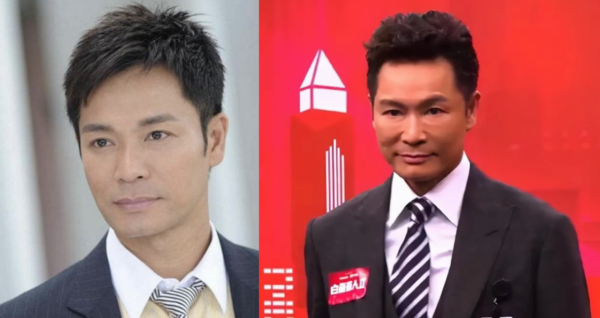 越整越難看後遺症一堆的男星：臉像鞋拔子，不能做表情，演戲難看