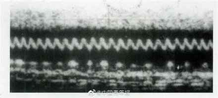 超聲心動圖之父王新房曾拿自己做實驗 超聲心動圖之父王新房曾拿自己做實驗