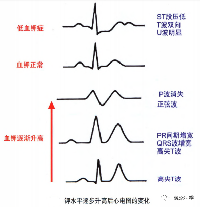 危急值血鉀1&period;55mmol&sol;L，立即補鉀被呵斥停止？
