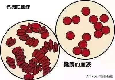 血液粘稠怎麼調理?醫生卻說,不要再被矇蔽了 血液粘稠怎麼調理?醫生卻說,不要再被矇蔽了