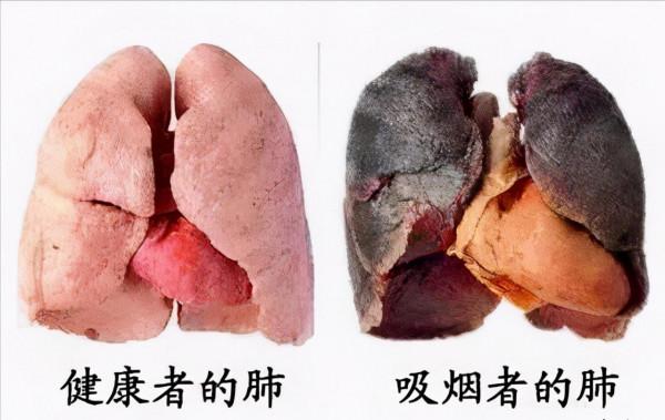 不想得癌症,一定要自律 不想得癌症,一定要自律