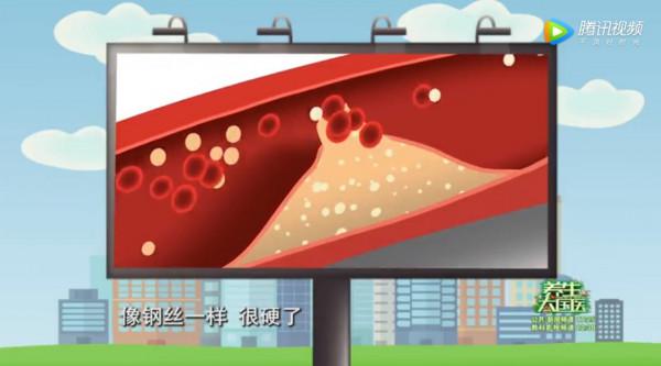 &OpenCurlyDoubleQuote;植物活化石&rdquo;是如何成為心血管的&OpenCurlyDoubleQuote;清道夫&rdquo;的？這是大自然獨一無二的饋贈