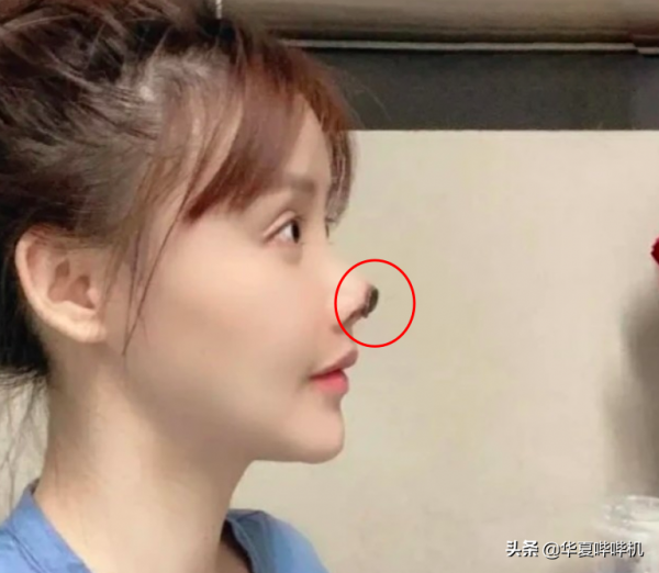 明星大型“翻車”現場，她們是如何整容變毀容的