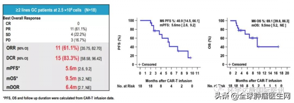 晚期胃癌全身轉移沒治了？日本專家給出救命新方案