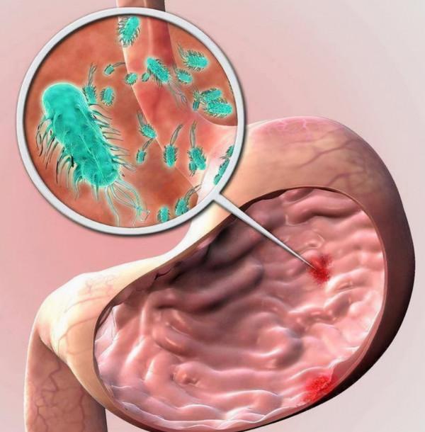 有胃病不能吃饅頭？坦白說：若想養胃，儘量少碰4物