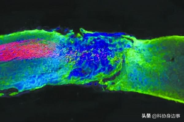 今日科技話題：抑制病原菌“幫手”、雷暴雲頂放電、“千年亂碼”、二維鈣鈦礦、新全息相機、“舞動”分子