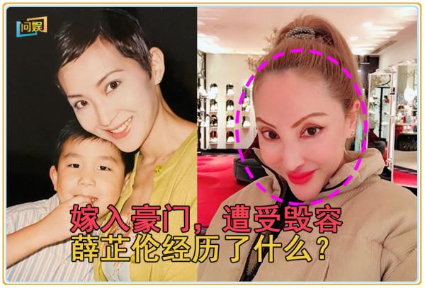 繼承鉅額遺產後嫁入豪門，又遭毀容，闊太薛芷倫經歷了什麼？