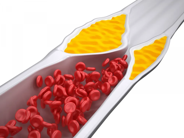 血壓高的人，差一步就是心臟病，日常做好這些，血壓更穩定