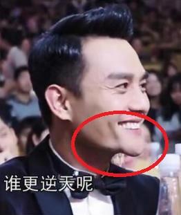 整容後遺症?都說帥卻看來非常“奇怪”的8個男星,各有各的怪法 整容後遺症?都說帥卻看來非常“奇怪”的8個男星,各有各的怪法