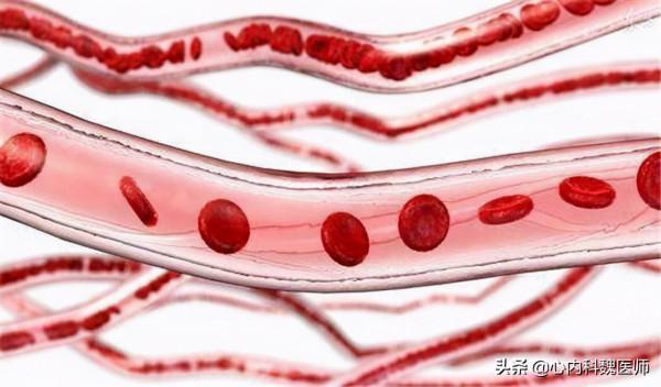 進口他汀太貴，能換成便宜的嗎？醫生告訴你高價和低價他汀的區別