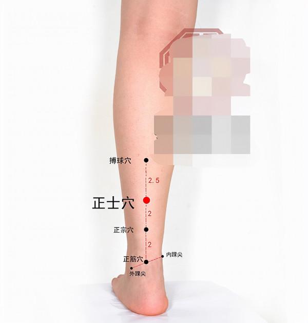 中醫針灸頸部疾病處方1