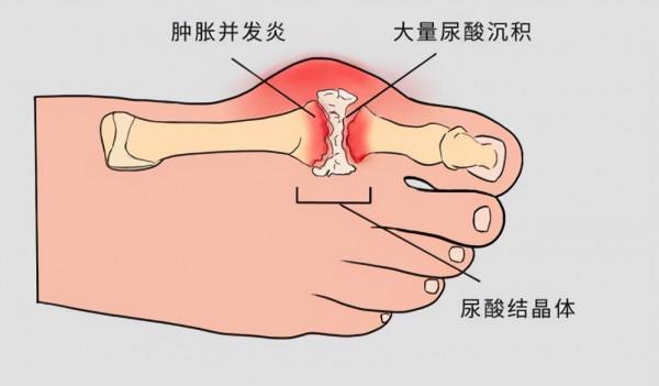 喝酒真的不能吃花生米嗎？提醒：3種食物儘量不要做下酒菜