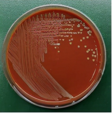 一隻基圍蝦引發的“血案”!常吃海鮮的人要注意 一隻基圍蝦引發的“血案”!常吃海鮮的人要注意