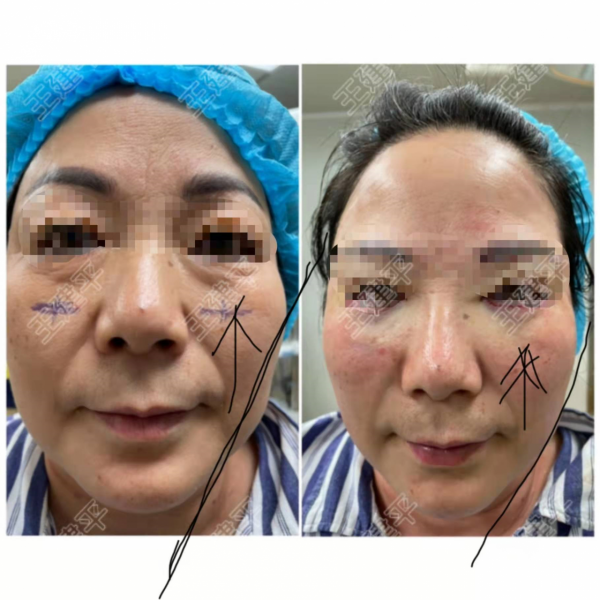 一個切口改善八個問題？快來看是什麼