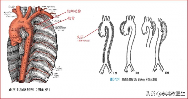 男子腰背痛，用止痛藥效果不佳，醫生：要在腹股溝通下開個小口