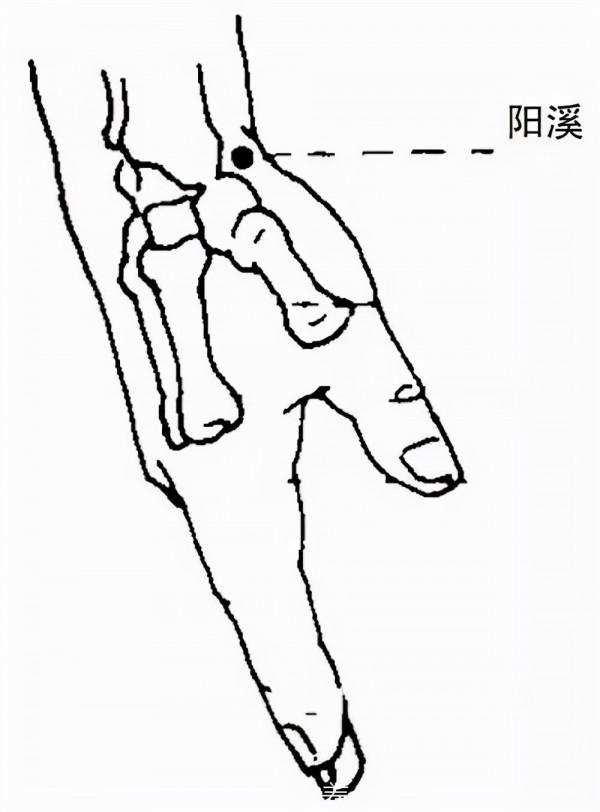 落枕辨經針灸療法