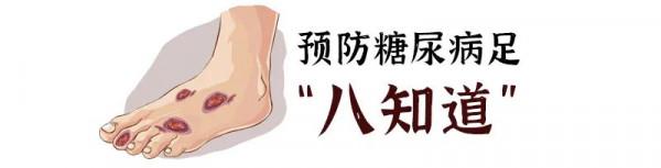【健康貼士】糖尿病患者做到這八點,可預防糖尿病足截肢(趾) 【健康貼士】糖尿病患者做到這八點,可預防糖尿病足截肢(趾)