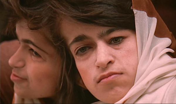 伊朗著名連體雙胞胎姐妹，29歲冒險做分離手術，分開兩小時殞命