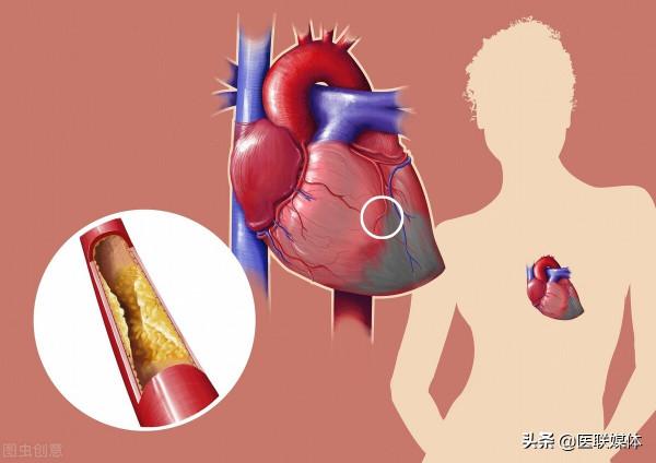 白天也老愛睡覺？多考慮這4種原因，還不快醒醒