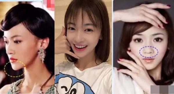 無孔不入！整容臉是如何毀掉各種電視劇的？