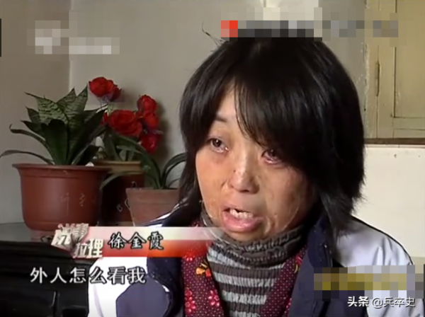 真實故事：山東女娃被開水燙成“鬼臉”，24歲結婚後又慘遭家暴