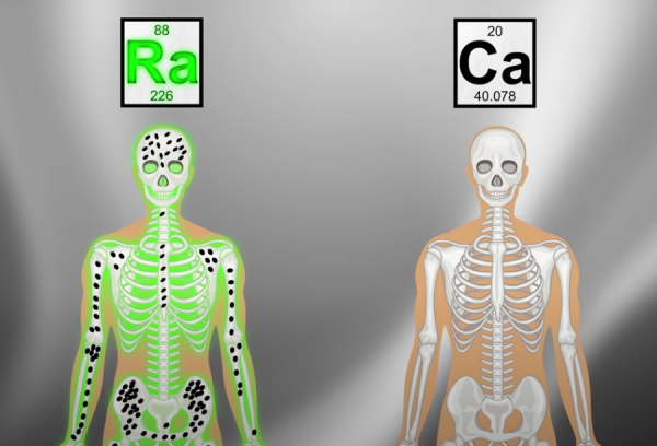 牙齒爛光,臉長巨瘤,骨頭還會發光,被美國資本家逼向絕路的女工 牙齒爛光,臉長巨瘤,骨頭還會發光,被美國資本家逼向絕路的女工