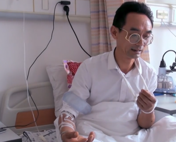 真實故事：農民工意外墜樓，腦袋被摔出血洞，後來搶救過來了嗎？