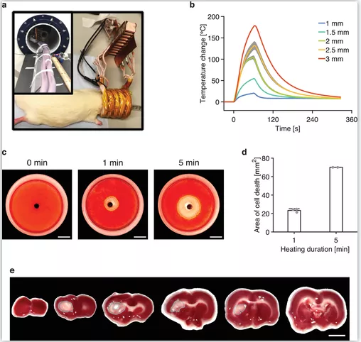 顛覆性科技！MRI&OpenCurlyDoubleQuote;微型切割刀&rdquo;除腫瘤