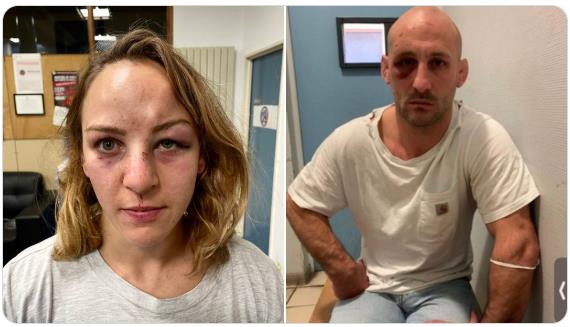 法國柔道冠軍妹子控告男友家暴，男友不服：看我都被揍成啥樣了