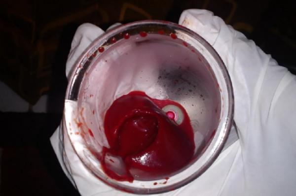 水蛭,從古到今它都是醫生的幫手...... 水蛭,從古到今它都是醫生的幫手......