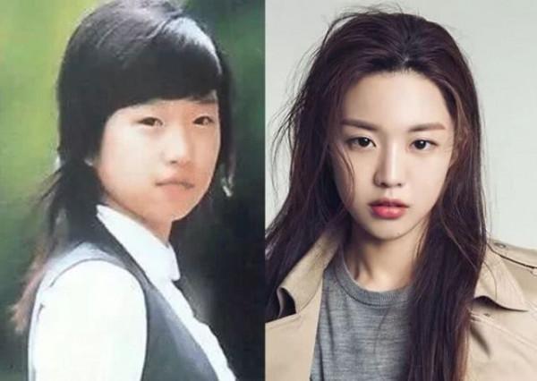 韓流明星整容堪比換頭:蔡妍換臉成功,任娜英李鍾碩鼻子變形 韓流明星整容堪比換頭:蔡妍換臉成功,任娜英李鍾碩鼻子變形