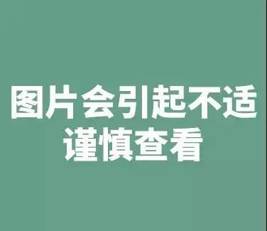 晚期腫瘤還能手術麼？他用這套理論給出了答案！