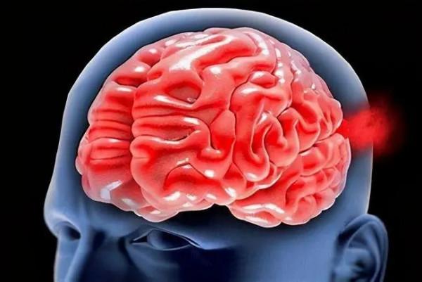 中年突發腦溢血，醫生提醒：控制血壓，做好預防很關鍵