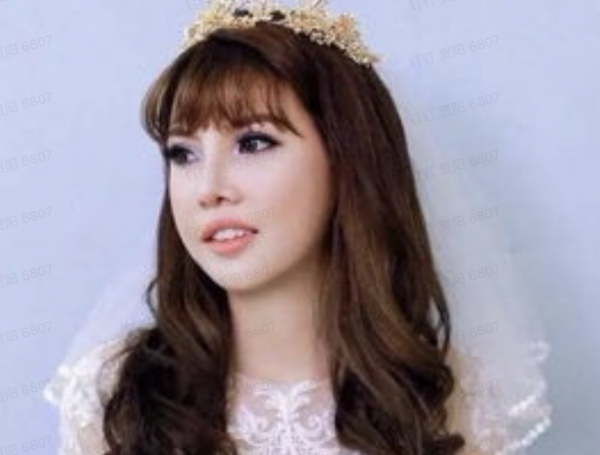 網路紅人鳳姐花3億越南盾整容美出新高度,嫁給富二代後過得如何 網路紅人鳳姐花3億越南盾整容美出新高度,嫁給富二代後過得如何