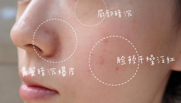 拯救面板乾燥，趕走造成皮脂膜受損的三大元兇