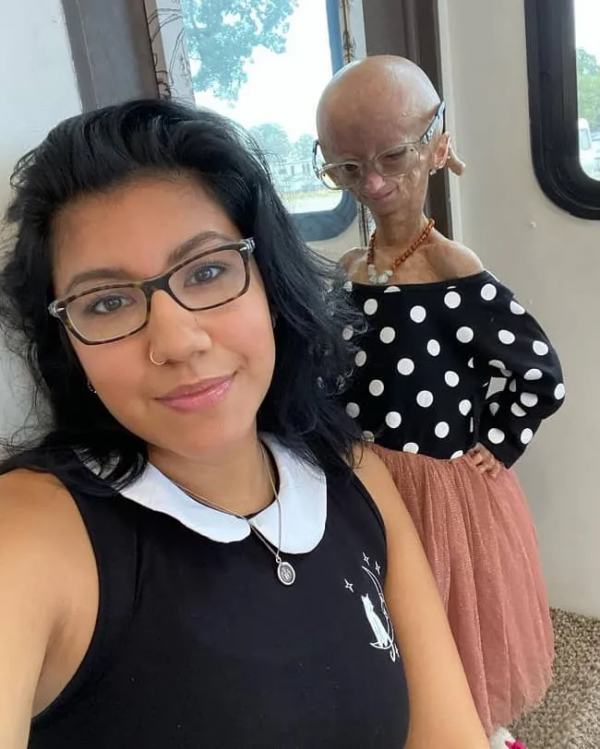 患早衰症15歲千萬粉絲少女博主逝世，粉絲：她終於不再痛苦了