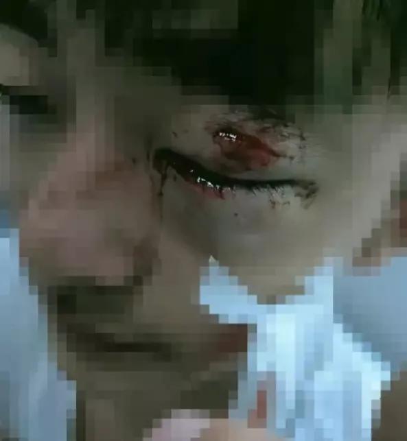 悲哀！教師一時衝動誤傷學生的眼睛，當場道歉卻被家長辱罵和毆打