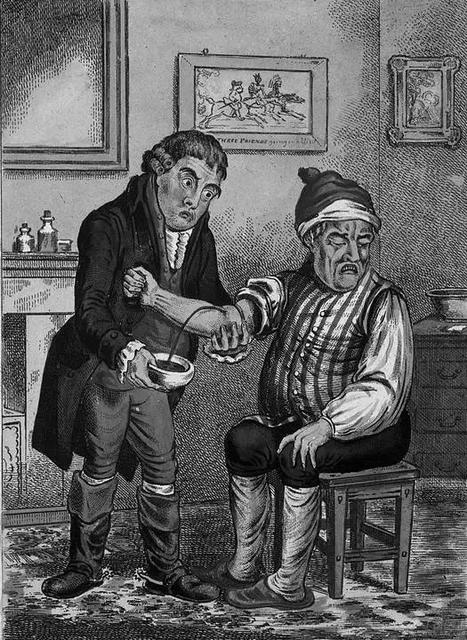 難以想象的“狗血”醫學理論及治療方法，盛行於中世紀的歐洲