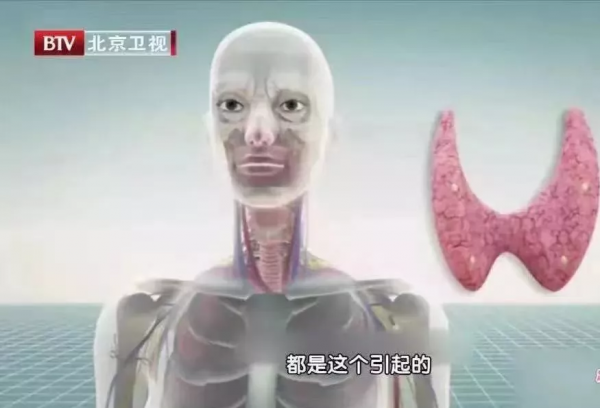 2年沒複查,息肉變成癌!B超報告裡出現“這些字眼”可能危險了 2年沒複查,息肉變成癌!B超報告裡出現“這些字眼”可能危險了