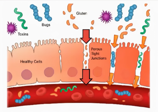 什麼是SIBO？水果和沙拉，也會傷腸道？SIBO詳解