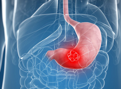 春節來了，美食如此多，如何保護我們的胃，