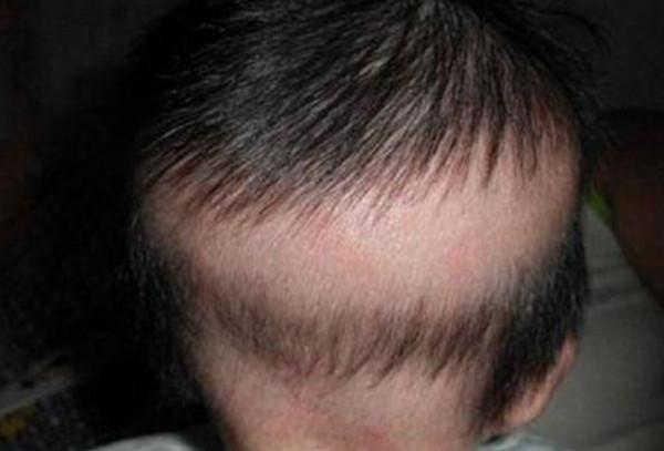 寶寶頭髮是發育的風向標，如何透過頭髮，判斷寶寶的發育情況？