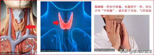 男子咽痛半年，醫生接二連三誤診，醫院：全院會診終找到病因