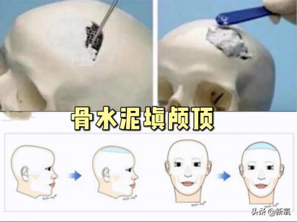 越努力越沒眼看,為什麼南韓女明星個個精緻又腫脹? 越努力越沒眼看,為什麼南韓女明星個個精緻又腫脹?