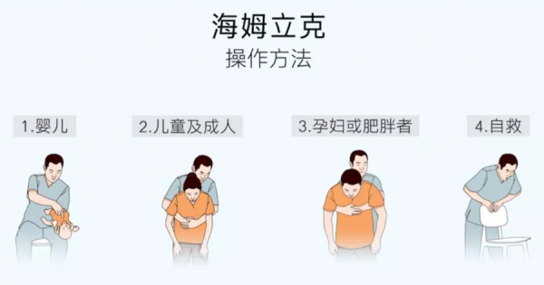 異物嗆入寶寶氣管，危機關頭，媽媽用海姆立克法化險為夷